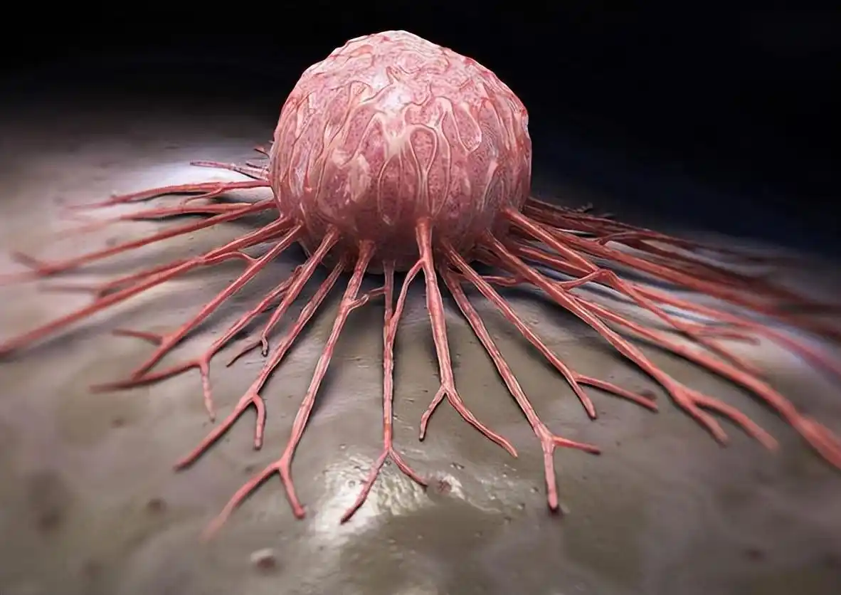 ȫ����ĳɰ�֢������Ԥ��