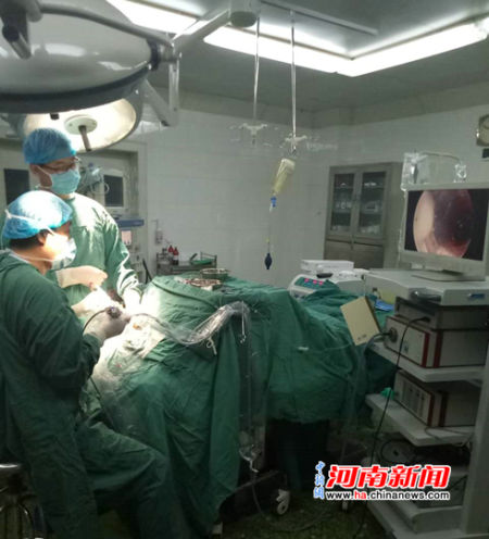 院成功开展首例神经内镜下单孔双侧脑室血肿外